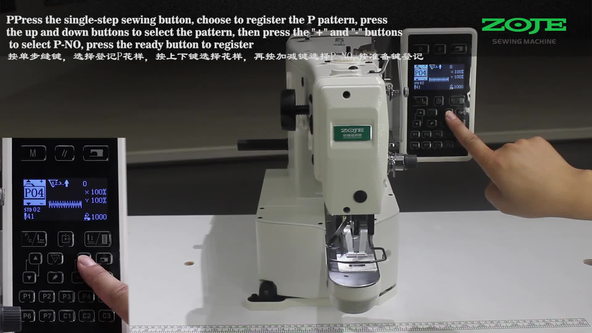 Registration of P pattern